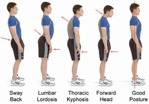 Middle back pain – the common causes explained - Complete